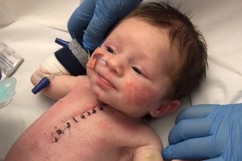 Brave baby survives open-heart surgery at 1-week old  