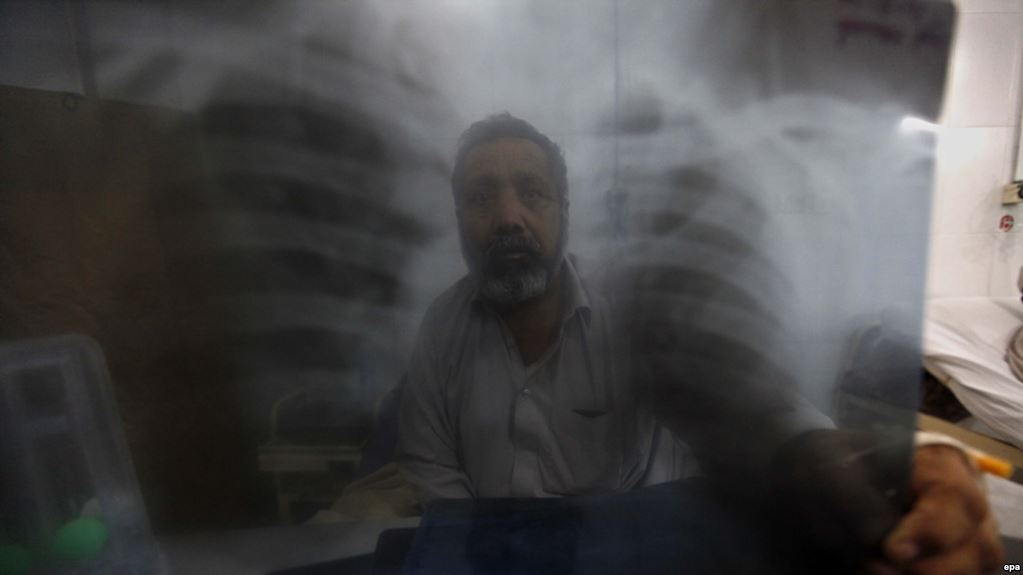 توبرکلوز به دلیل عدم آگهی مردم، در افغانستان قربانی می گیرد