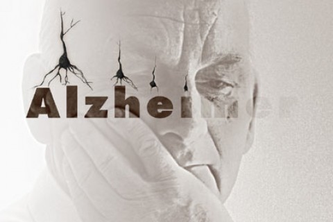 10 علامت هشدار دهنده آلزایمر