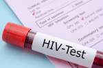 نتایج امیدوار کننده آزمایش "واکسن HIV" در فاز انسانی