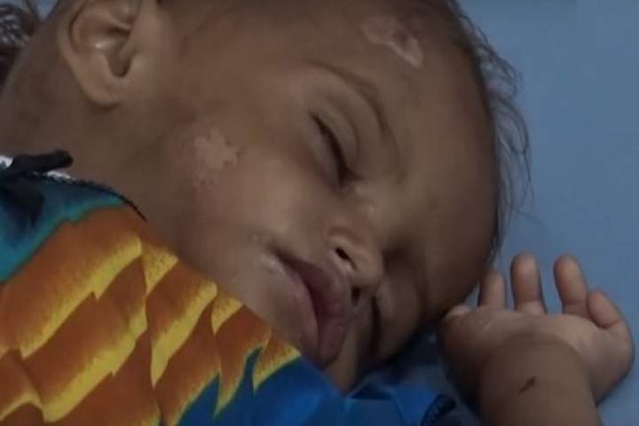وضعیت فاجعه بار انسانی در الحدیده یمن