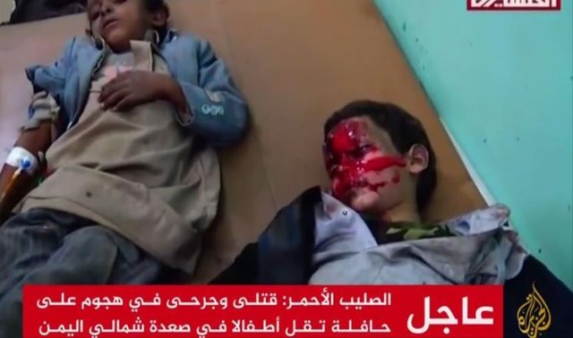 ۴۳ شهید و ۶۳ زخمی در حمله خونین سعودی‌ها به موتر حامل کودکان در صعده یمن