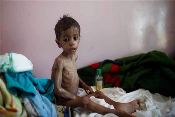 آغاز موج سوم شیوع بیماری وبا در یمن