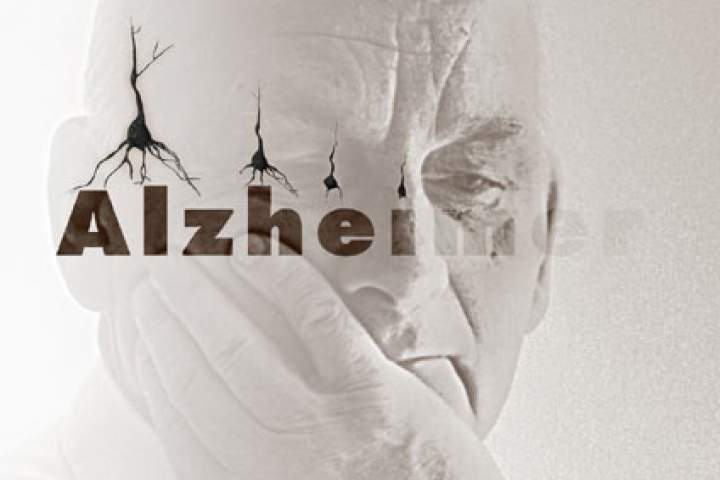 افزایش خطر ابتلا به آلزایمر با خواب روزانه!
