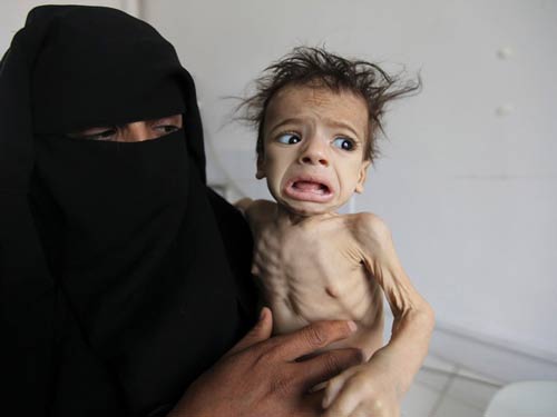 5.2 million Yemeni kids on brink of famine amid Saudi war: Save the Children