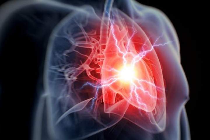 کشف روش آسان و ارزان تشخیص سریع خطر حمله قلبی