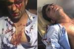 ورزشکار مشهور مبارزات آزاد کشور مورد حمله قرار گرفت  