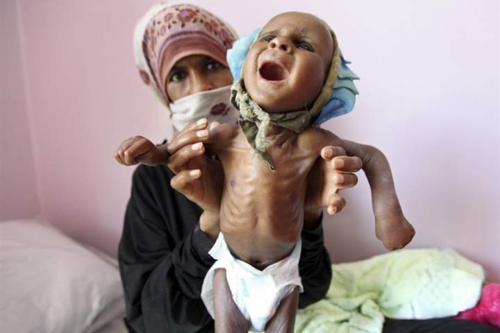 یمن درحال نزدیک شدن به فاجعه بزرگی انسانی است