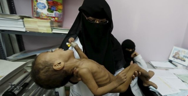 درخواست سازمان ملل برای کمک ۴ میلیارد دالری به یمن