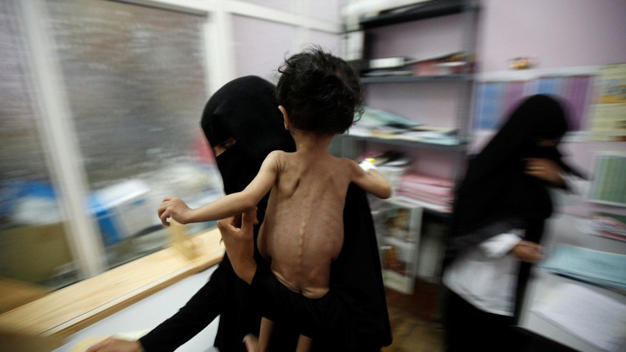 UN food agency steps up aid to Yemen, to help another 4mn people