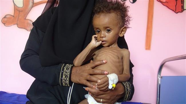 More than 50% of Yemen’s population facing ‘severe acute food insecurity’: Survey