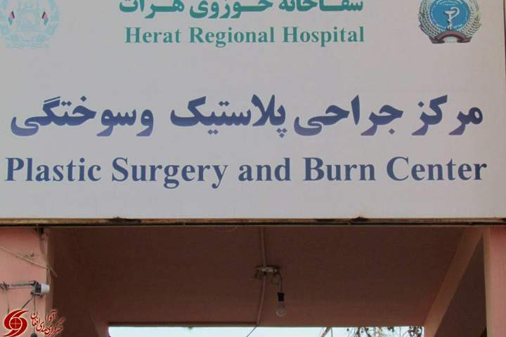 تداوی حدود 62 درصد از بیماران سوختگی در شفاخانه حوزوی هرات