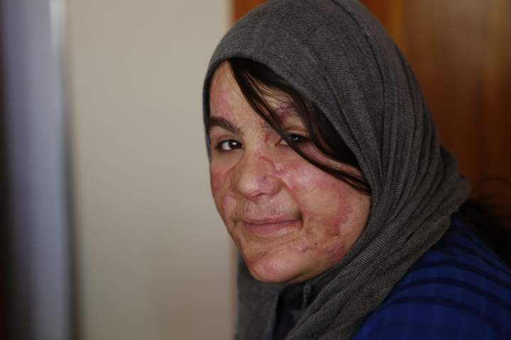 More than 2,000 cases of violence recorded against women in Afghanistan in a year