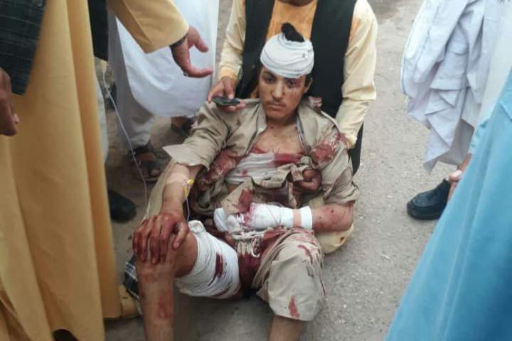 زخمی شدن ۵ تن در یک رویداد انفجاری در هرات