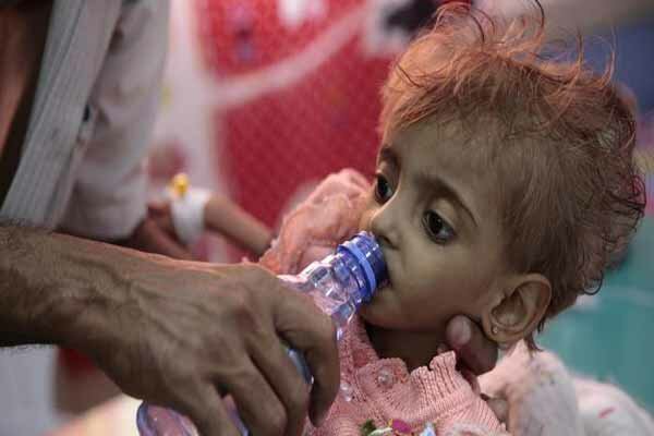 ابتلای نیم میلیون یمنی به وبا همزمان با ادامه جنگ عربستان