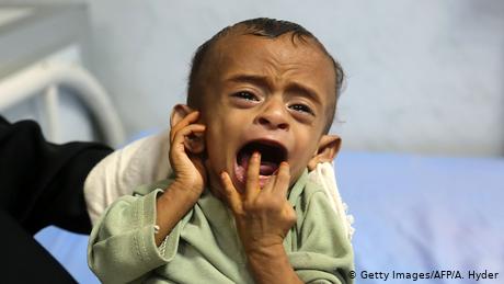 کودکان یمن؛ قرباني امیال اقتصادی و ارضای قدرت