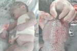کشته شدن یک طفل ۸ ماهه در بطن مادرش در حملات هوایی در سرپل