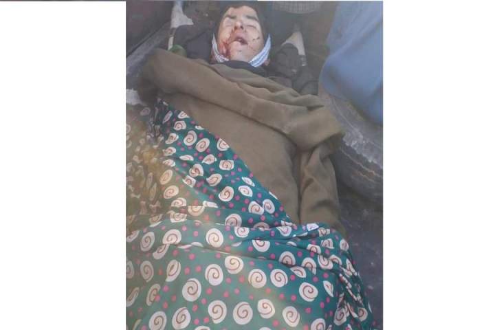 افراد مسلح در تخار پس از کشیدن چشم یک جوان او را تیر باران کردند
