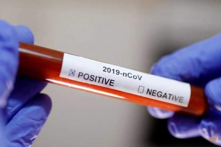 ثبت دو واقعه مشکوک مصاب به ویروس کرونا در بادغیس