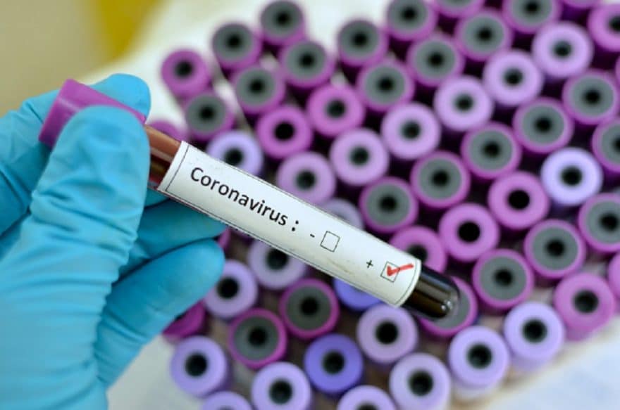 Foreign diplomats contract coronavirus as Afghanistan reports 10 new cases