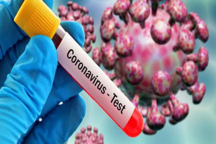 نخستین فوتی بر اثر ویروس کرونا در افغانستان ثبت شد