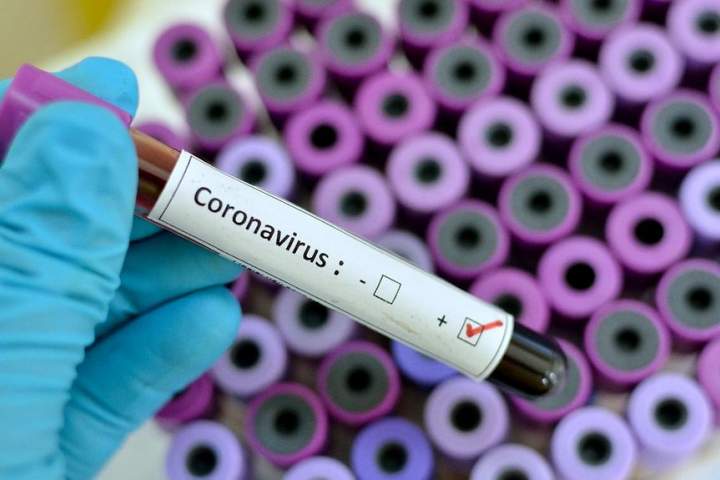ثبت 50 مورد جدید ابتلا به کووید19؛ شمار واقعات مثبت ویروس کرونا در کشور به 1226 مورد رسید