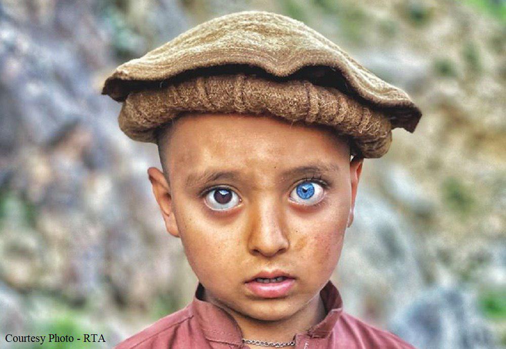 Photos of Afghan child with unique eye colors go viral