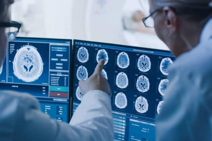 شناسایی "تومور مغزی" با هوش مصنوعی شرکت اینتل