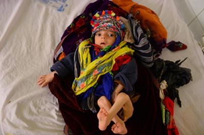 Deadly child malnutrition rises in Afghanistan at alarming rate: UN