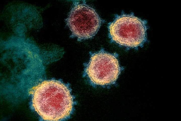 پروتئین‌هایی که مانع ورود کروناویروس به سلول‌های انسان می‌شوند