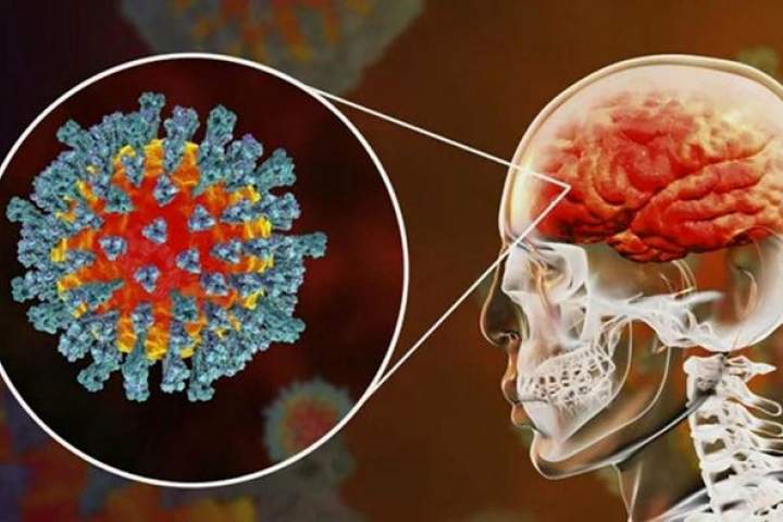 تاثیرات مخرب ویروس کرونا بر مغز و راهکار‌هایی ساده برای جلوگیری