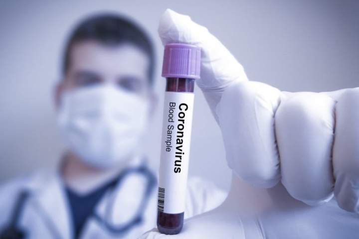 شمار کل مبتلایان به ویروس کرونا در کشور به 39 هزار و 254 نفر رسید