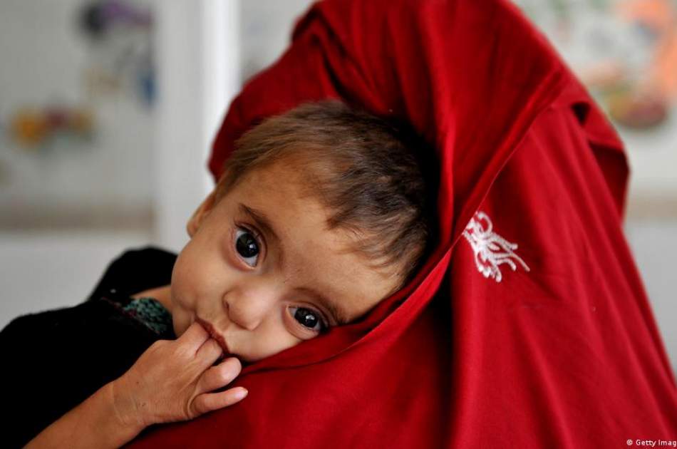 ابراز نگرانی یونیسف از افزایش سوءتغذیه در کودکان افغانستانی