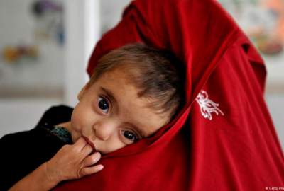 ابراز نگرانی یونیسف از افزایش سوءتغذیه در کودکان افغانستانی