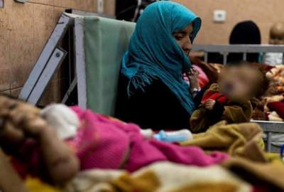 Spread of cholera disease in Jawzjan; 18 thousand people infected in 5 districts