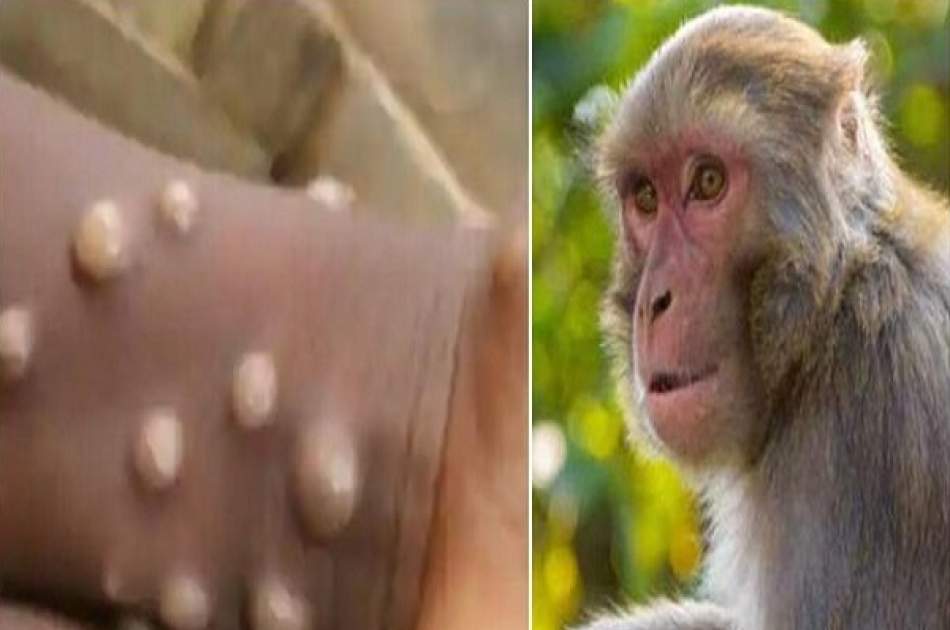 سازمان صحی جهان در تلاش برای تغییر نام «آبله میمون»