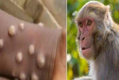 سازمان صحی جهان در تلاش برای تغییر نام «آبله میمون»