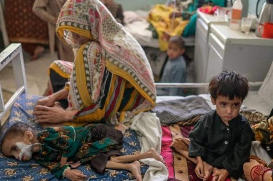 مرگ ۲۰ کودک و ابتلای هزاران نفر به سوء تغذیه در بغلان