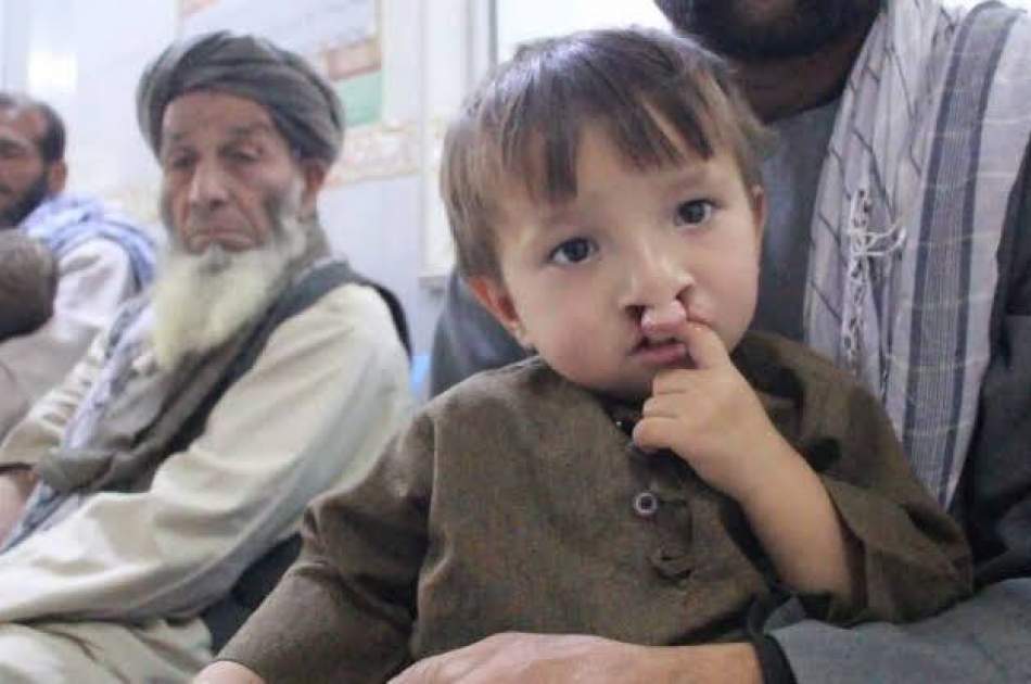 ۲۰۰ کودک کام‌چاک و لب‌چاک در قندوز درمان می‌شوند