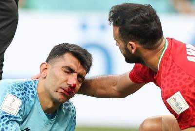 ایران جام جهانی فوتبال را با بدشانسی و شکست آغاز کرد