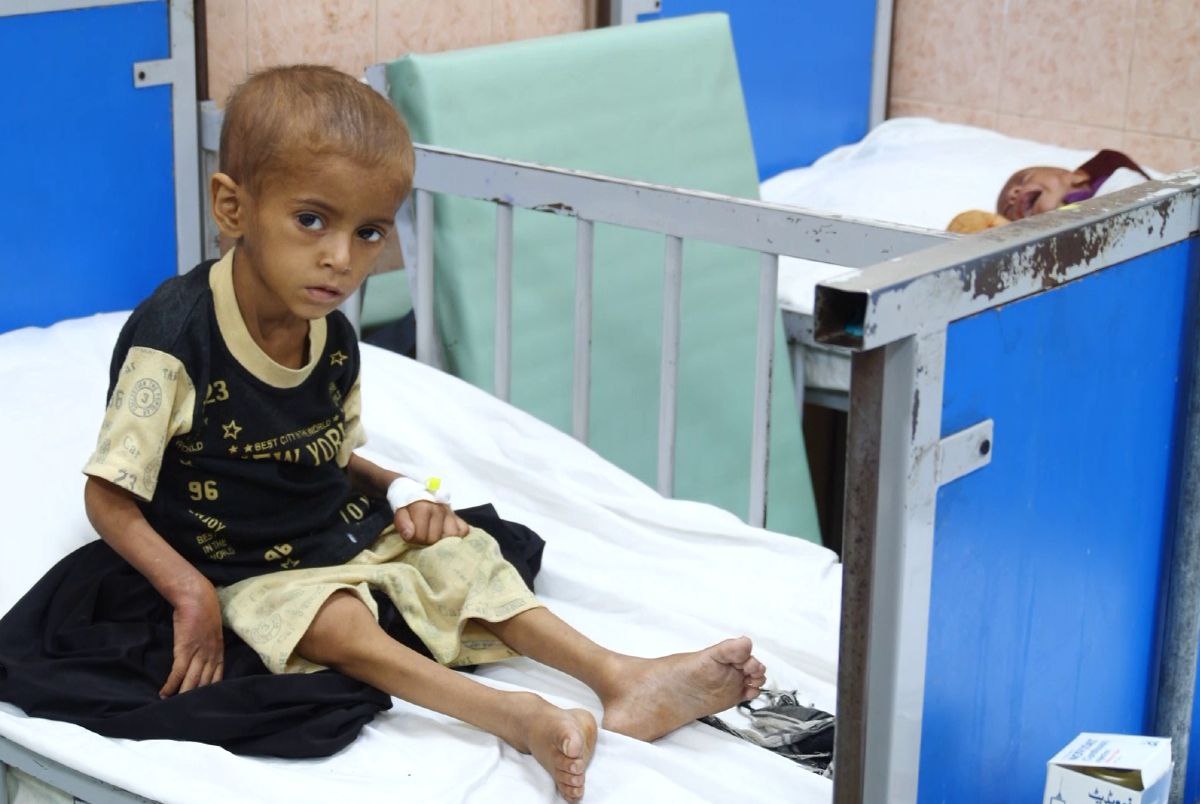 درمان بیش از ۴۸ هزار و ۸۰۰ کودک مبتلا به سوءتغذیه‌ حاد