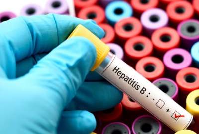 حدود یک میلیون نفر در افغانستان به ویروس هپاتیت (زردی سیاه) مبتلا هستند