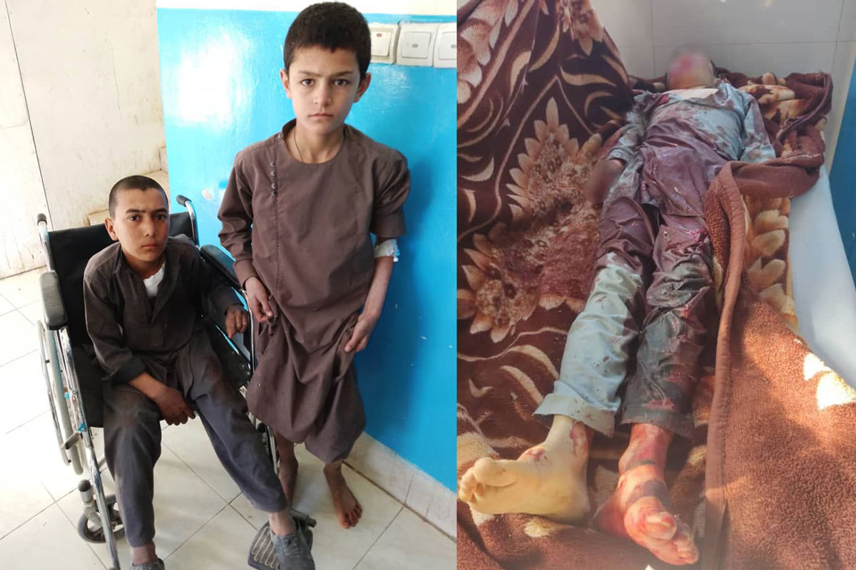 کشته و زخمی شدن سه کودک بر اثر انفجار بمب دستی منفجر نشده