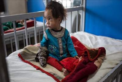 ابتلای 3 میلیون کودک افغانستانی به سوءتغذیه حاد